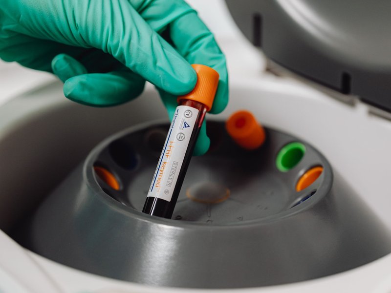 Strategic Healthcare Consolidators Acquiring Blood & Tissue Banks Companies
