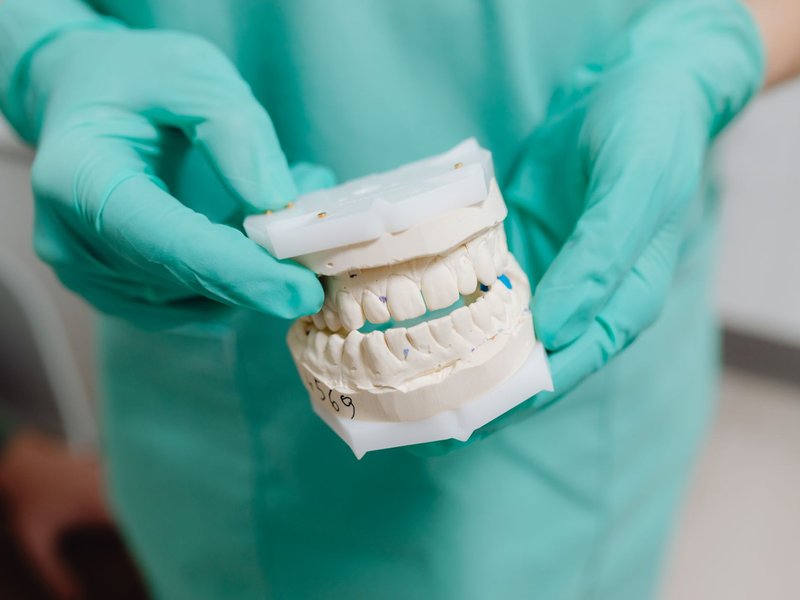Dental Laboratories M&A Advisor Confidential Consultation