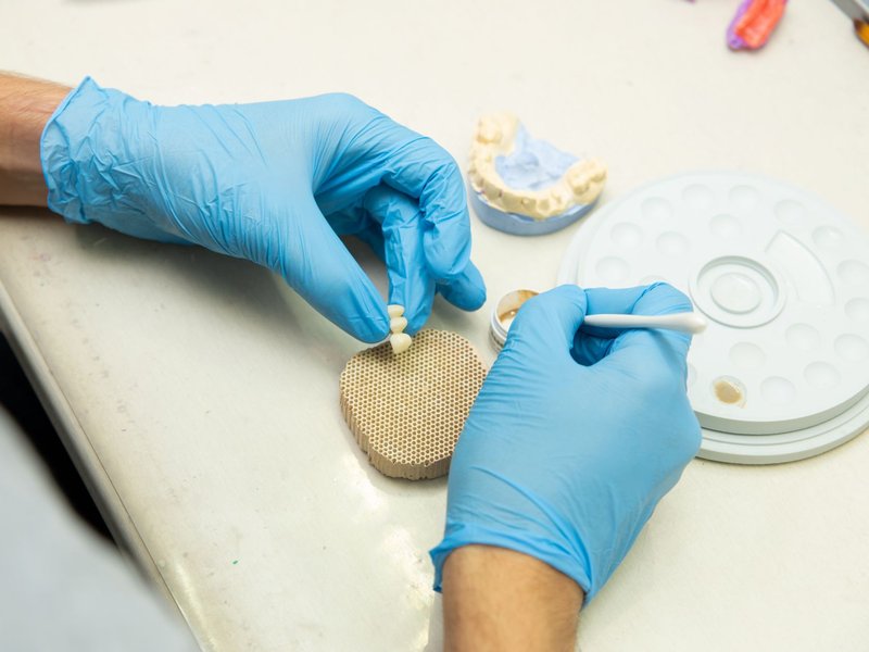 Industrial Private Equity Platforms Investing in Dental Laboratories Businesses