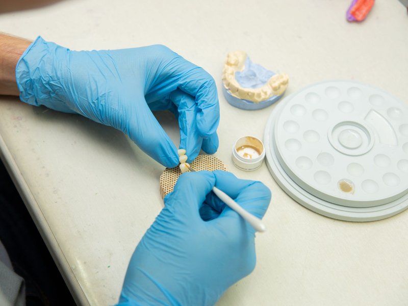 Manufacturing Search Funds & Family Offices Buying Dental Laboratories Operations